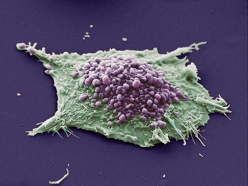 Стволовая клетка — инструмент жизни и смерти. Раковые стволовые клетки.