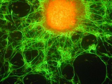 Бессмертные клетки организма — стволовая и раковая. Чем они отличаются?